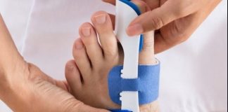 Things to Consider Before Buying Bunion Correctors