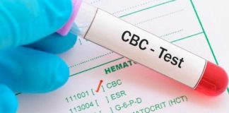 A Simple Guide on Vitamin Deficiencies and Nutrition Levels from Blood Testing
